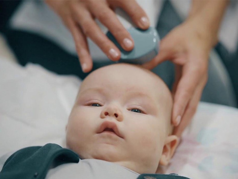 Процедура нейросонографии младенца